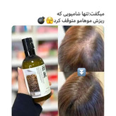 شامپو رزماری و کاج سوزنی معجزه ای طبیعی برای توقف ریزش و ضخیم سازی مو
